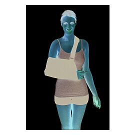ProCare Unisex Blue Cotton / Polyester Arm Sling, Small